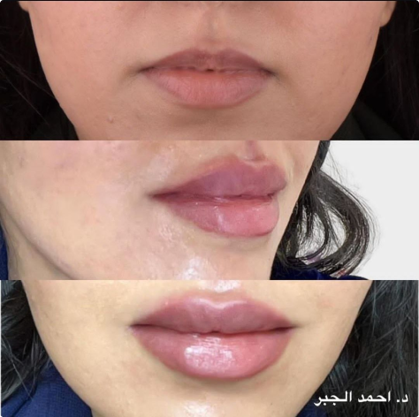 د. أحمـد الجــبر