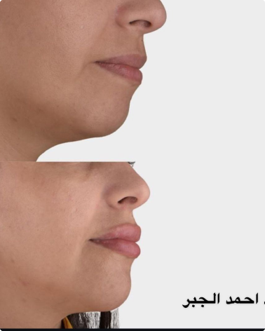 د. أحمـد الجــبر