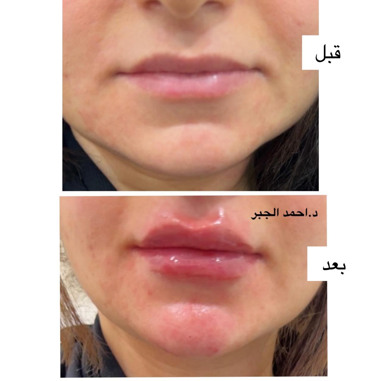 د. أحمـد الجــبر