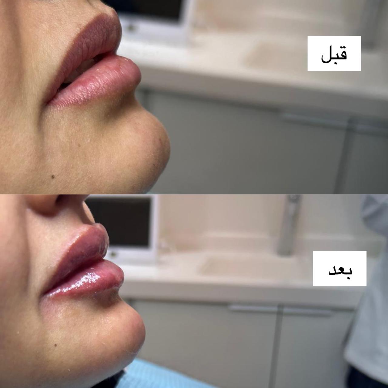 د. أحمـد الجــبر